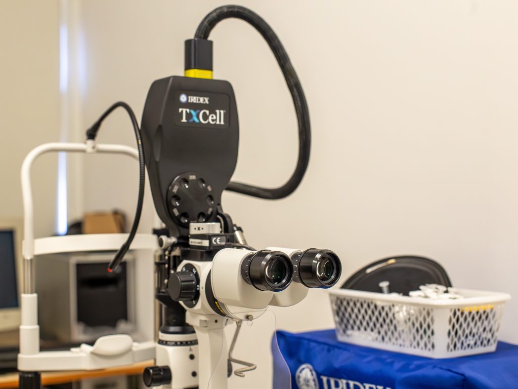 Iridotomia laser